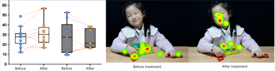 Improved active eye?connect